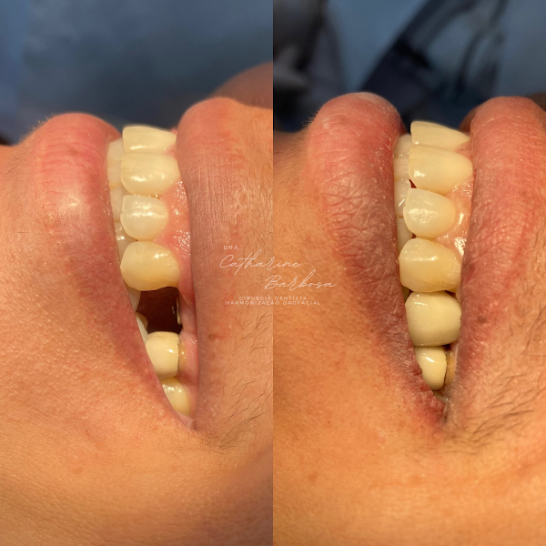 Foto 3 de Cirurgiã dentista | Implantes dentários | Atendimento multidisciplinar | Harmonização Orofacial