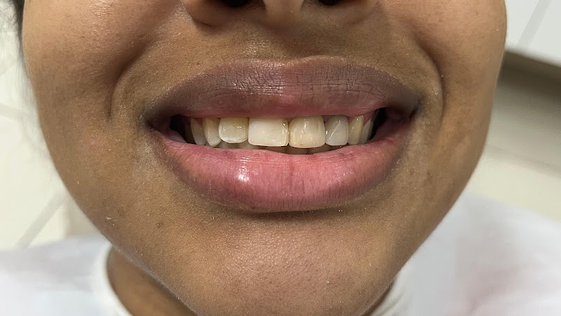 Foto 2 de Cirurgiã-Dentista - Itabuna - Clínica Dra. Lavynnya Vilaça