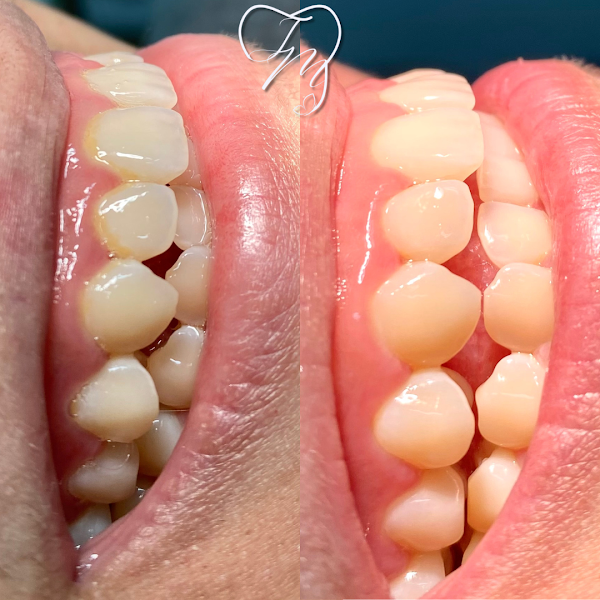 Foto 2 de Cirurgiã Dentista - Júlia Mesacasa