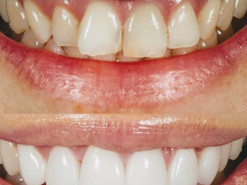 Foto 2 de CIRURGIÃO DENTISTA