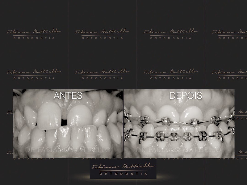 Foto 2 de Cirurgião Dentista Dr. Gabriel Mattiello