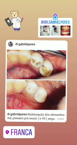 Foto 2 de Cirurgião Dentista Dr.Gabriel Peres