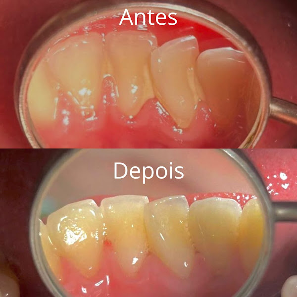 Foto 3 de Cirurgião Dentista Dr. José Cerezer