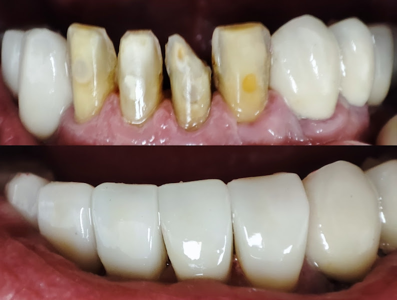 Foto 4 de Cirurgião Dentista- Dr. Nilo Vaz - CROSP 48857 - Avenida Paulista