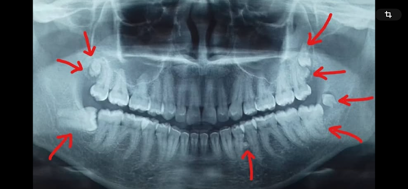 Foto 3 de Cirurgião Dentista/Dr. Pablo Cavalcante Galvão/MJM