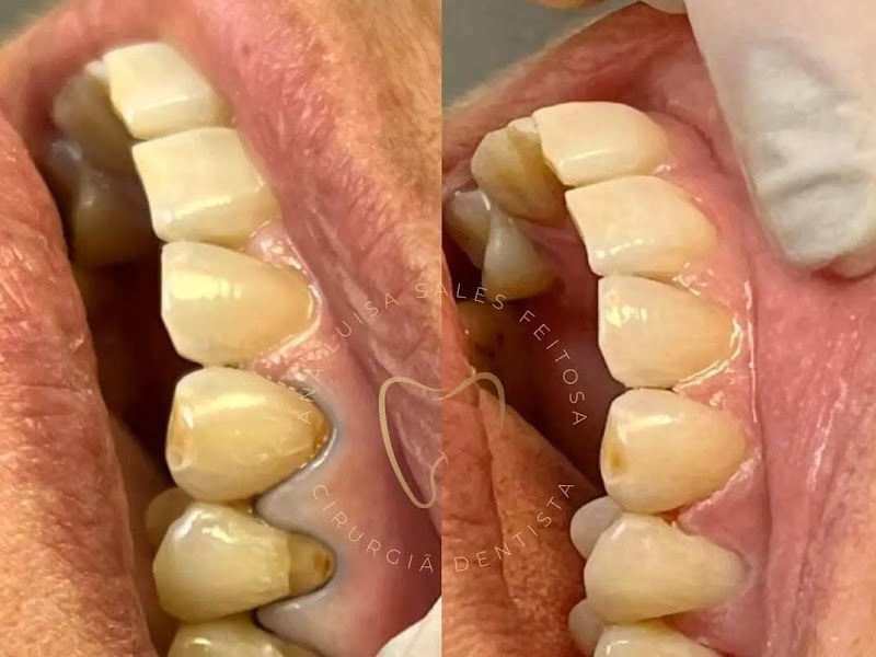 Foto 2 de Cirurgião Dentista Dr. Vadim Gomes De Carvalho