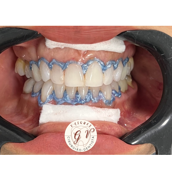 Foto 3 de Cirurgião-Dentista Guilherme Vasques