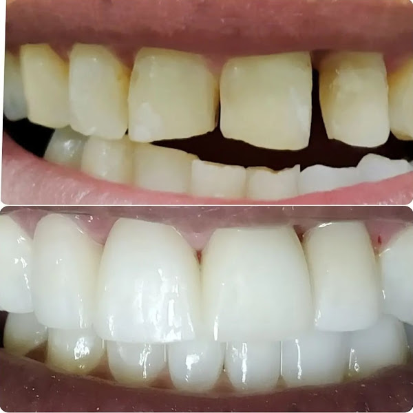 Foto 3 de CISO Clínica Integrada De Saúde Odontológica