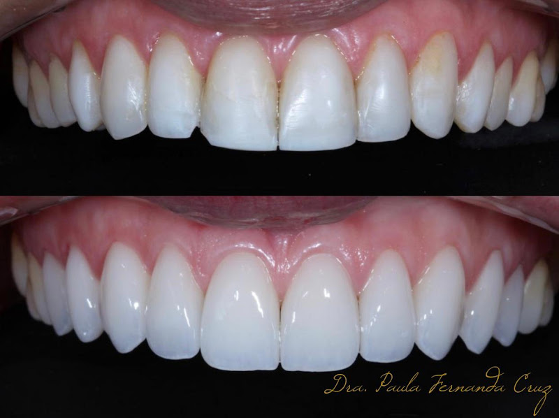 Foto 3 de Cisol Odontologia (Centro Integrado de Saúde Odontológica)