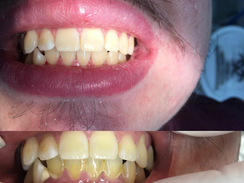 Foto 11 de Cisos Odontologia Integrada - Unidade Paraná 191