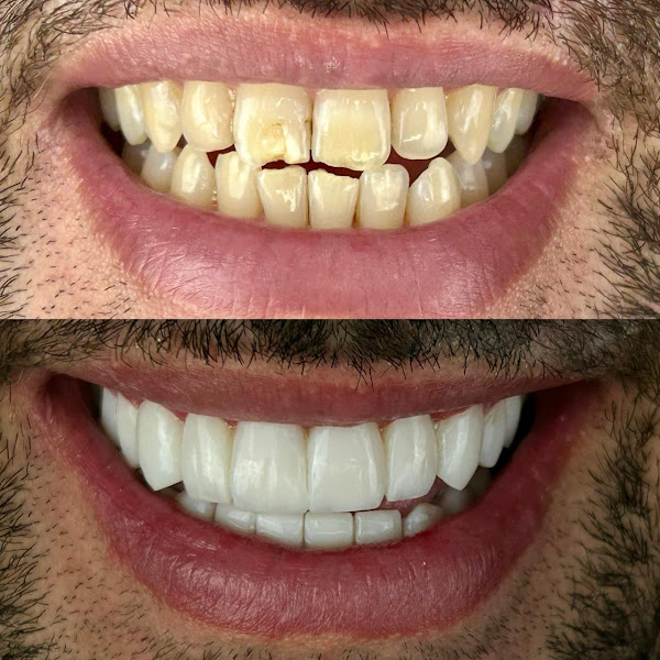 Foto 2 de Citag Odontologia - Facetas e Implantes | Bacacheri