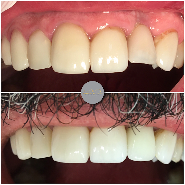 Foto 2 de Citro OdontoCare CROSP: 023040