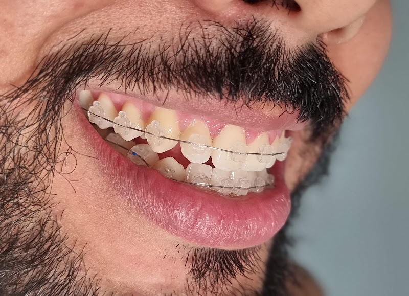 Foto 3 de CL Clínica Odontológica | Dentista em Itabuna | Reabilitação oral e Estética Facial | Prótese | Implante | Ortodontia