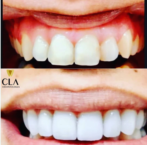 Foto 2 de CLA Odontologia