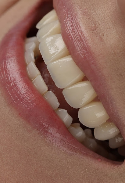 Foto 2 de Clara Oliveirah - Estética Oral & Facial