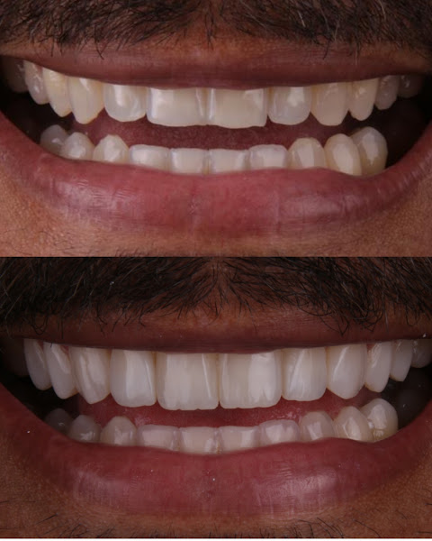 Foto 3 de Clara Oliveirah - Estética Oral & Facial