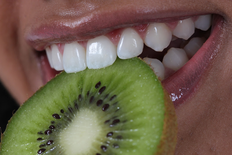 Foto 2 de CLAREAMENTO DENTAL GOIANIA