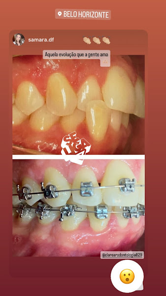 Foto 3 de Clarear Odontologia