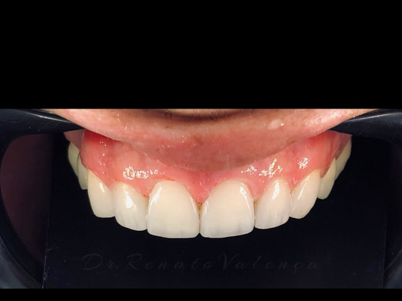 Foto 3 de Clarissa Valença | Harmonização e Estética Recife