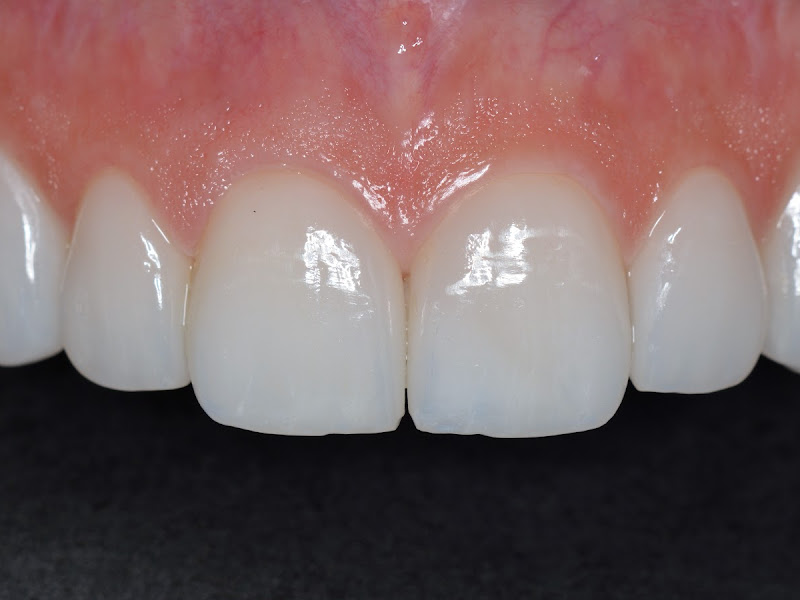 Foto 9 de Claudia Klein Odontologia- Dentista em Passo Fundo