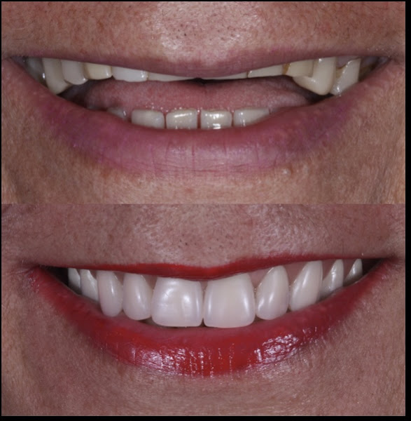 Foto 2 de Claudia Rosana Rocha de Castro Alves Linhares ES