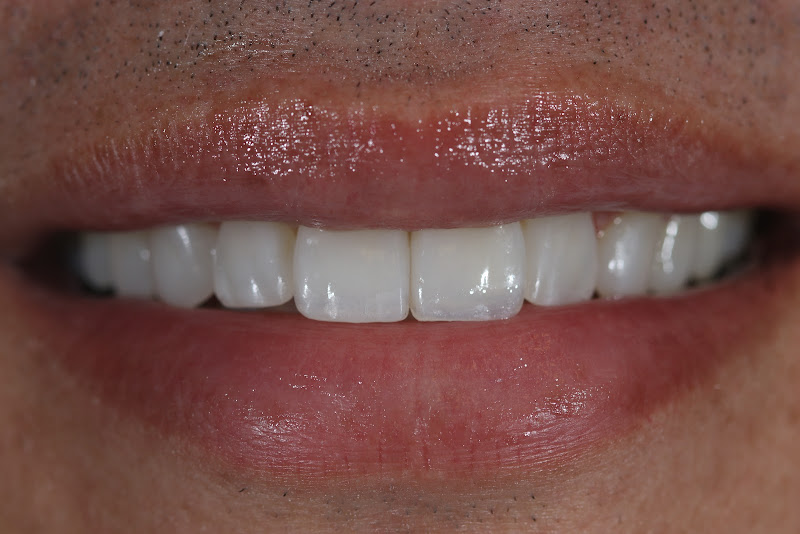 Foto 3 de Claudia Rosana Rocha de Castro Alves Linhares ES