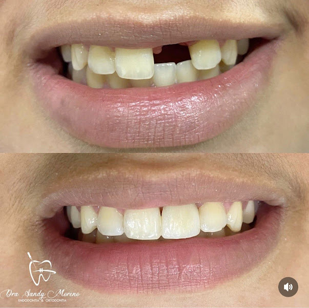 Foto 3 de Claudino Odontologia | Dentista no Bessa