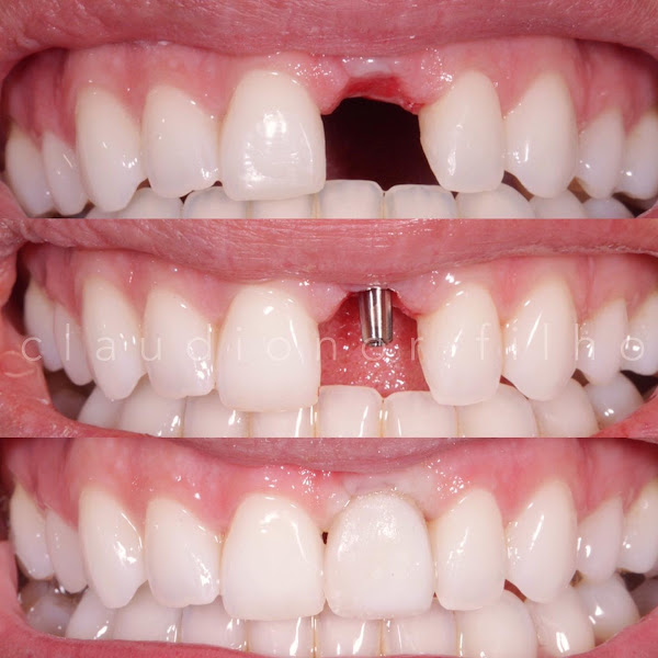 Foto 2 de Claudionor Filho Odontologia