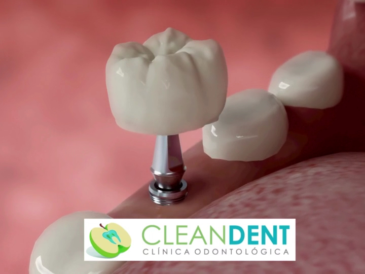 Foto 4 de CleanDent | Dentista São José SC