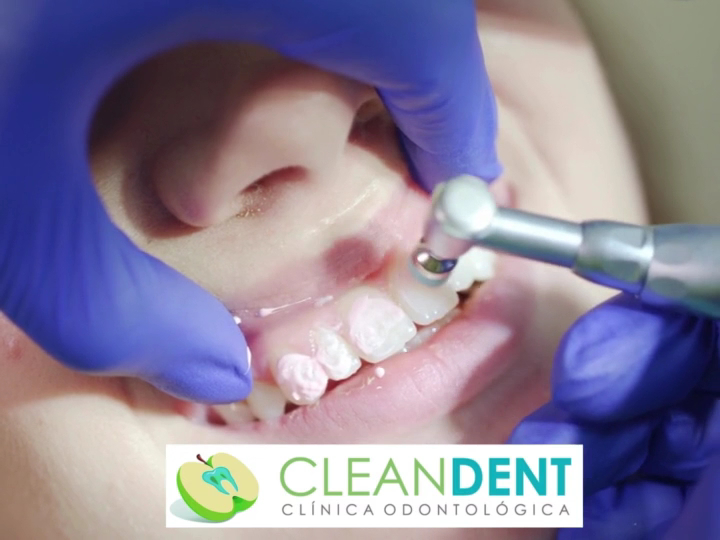 Foto 5 de CleanDent | Dentista São José SC