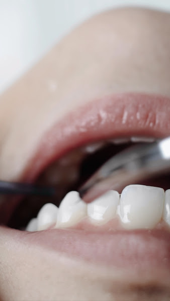 Foto 3 de Cleanical - Estética em Odontologia