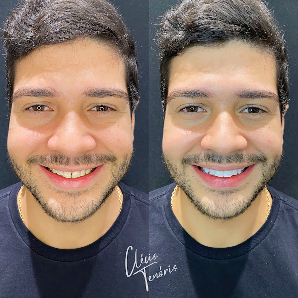 Foto 2 de Clécio Tenório - Consultório Odontológico