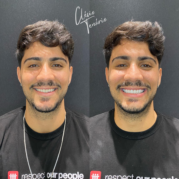 Foto 3 de Clécio Tenório - Consultório Odontológico