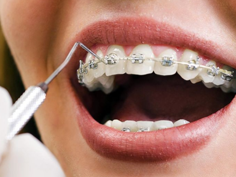 Foto 10 de Click Odonto - Campo Grande