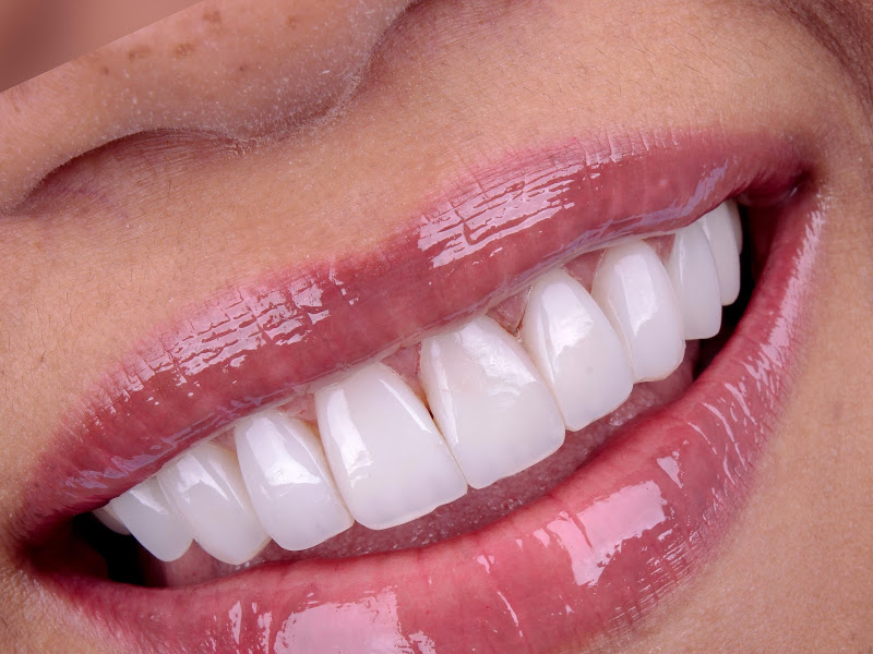 Foto 9 de Clident Clínica Odontológica