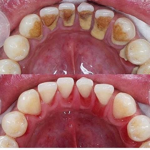 Foto 2 de Clident Odontologia