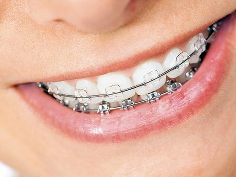 Foto 9 de Clident Odontologia