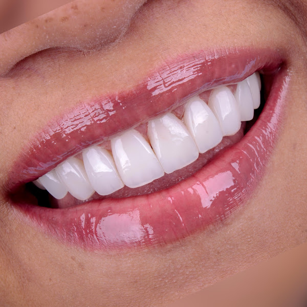 Foto 2 de Clidente Clínica Odontológica