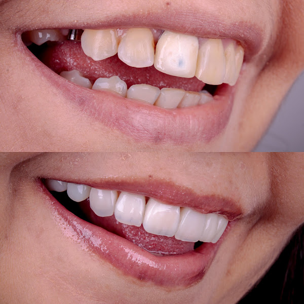 Foto 3 de Clidente Clínica Odontológica - Unidade José Bonifácio