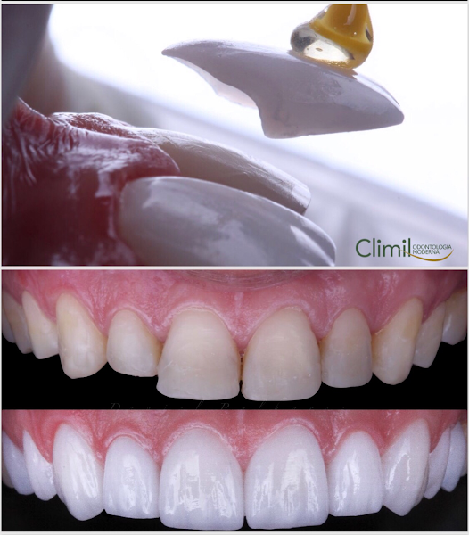 Foto 3 de Climil Odontologia Moderna