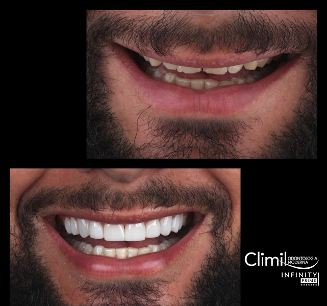 Foto 4 de Climil Odontologia Moderna