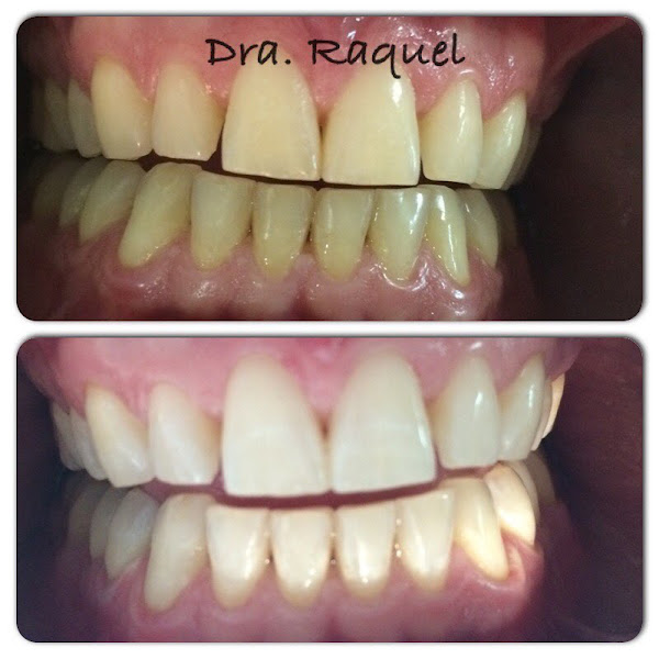 Foto 3 de Clinhappy Odontologia