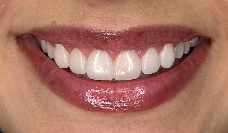 Foto 2 de CLINIC BE - Odontologia e Autocuidado