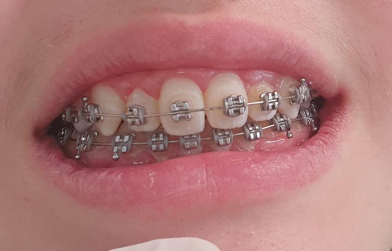 Foto 2 de Clinica Acertt Odontologia