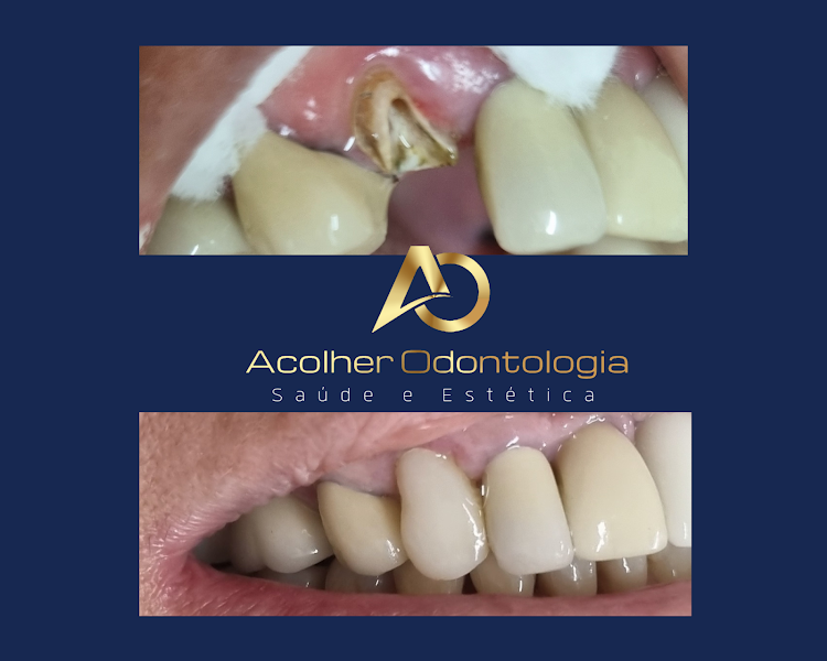 Foto 3 de Clínica Acolher Odontologia(CECÍLIA BRANDÃO)