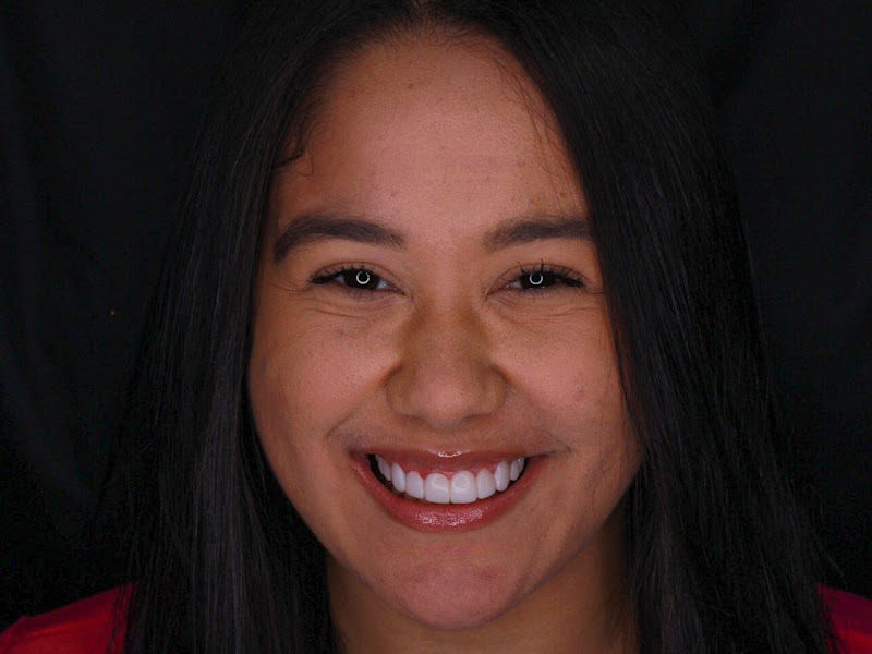 Foto 8 de Clínica Alavarce | Dra. Lygia Alavarce e Equipe | Itaquera | Aparelhos Invisíveis | Aparelho Dentário | Implantes |