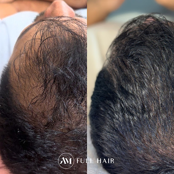 Foto 3 de Clínica AM- Dra. Adrielle Moraes | Tricologia & Harmonização Facial