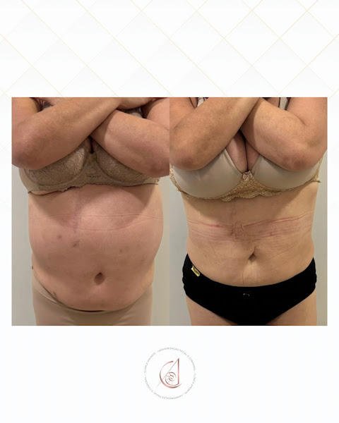 Foto 3 de Clínica Amonite - Harmonização Facial e Corporal - Paranaguá