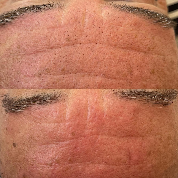 Foto 2 de Clínica Ana Carolina Malatrasi | Estética Facial e Acupuntura em Botucatu