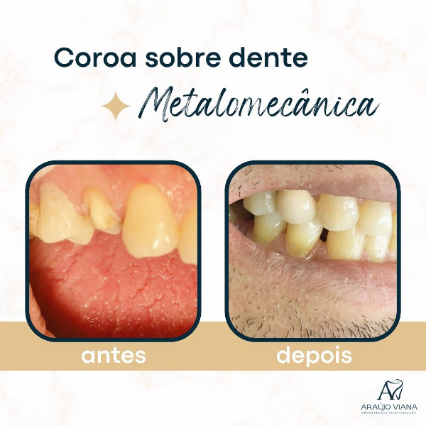 Foto 3 de Clínica Araújo Viana Odontologia